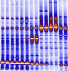 Nanopore direct RNA sequencing finds cancer\'s fingerprint to improve early detection