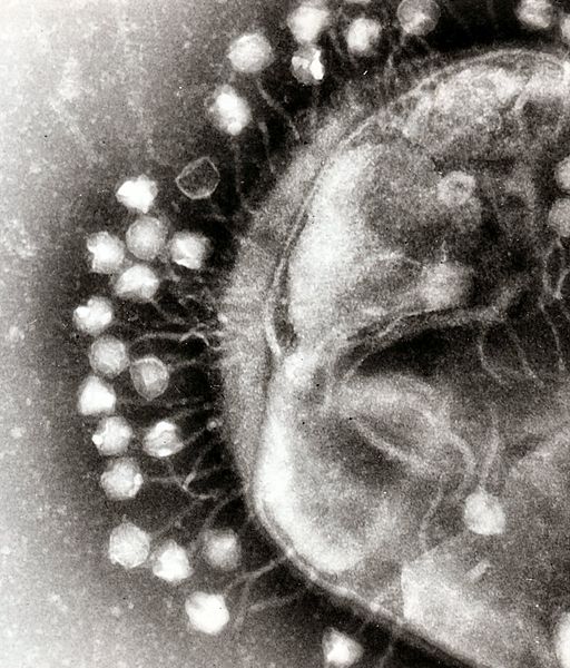 Genetically modified phages deliver bacterial toxins to combat multidrug-resistant E. coli