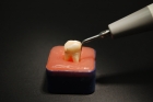 Nanoparticles offer enhanced treatment for root canal infection with fewer complications