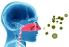 Inhalable therapy uses mussel-inspired nanoparticles to target lung cancer cells