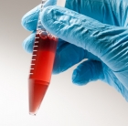 A novel biomaterial for regenerative medicine: Scientists develop acellular nanocomposite living hydrogels